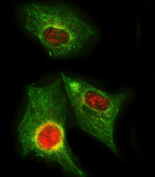  IF analysis of PPP2R5A using anti-PPP2R5A antibody (A05935-2) and anti-Beta Tubulin antibody (M01857-3)