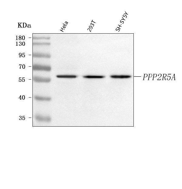  Western blot analysis of PPP2R5A using anti-PPP2R5A antibody (A05935-2)