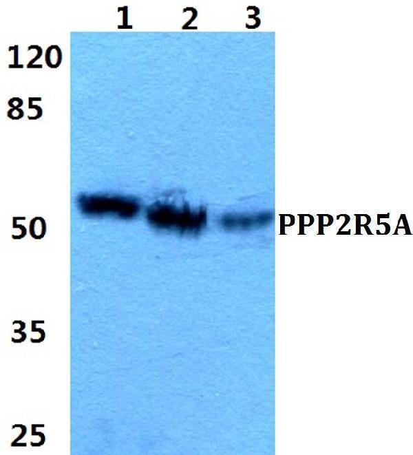 a05935 ppp2r5a primary antiboties wb testing 1
