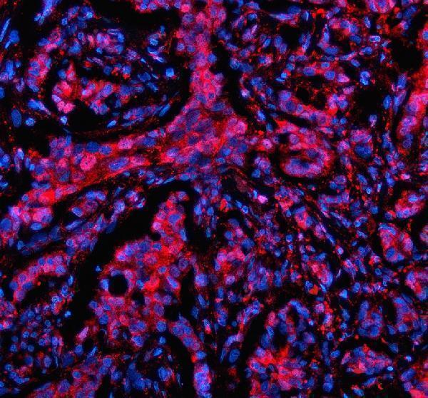 a05937 1 mtmr3 primary antibodies if testing 1