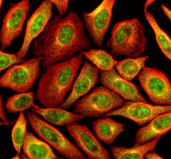 a05937 1 mtmr3 primary antibodies if testing 2