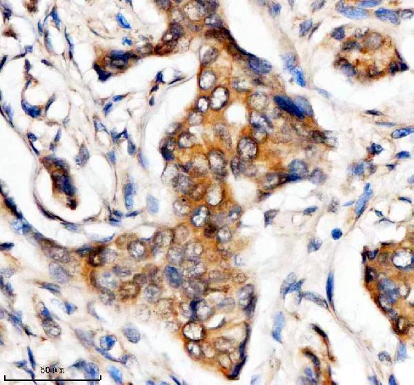 IHC analysis of MTMR3 using anti-MTMR3 antibody (A05937-1)