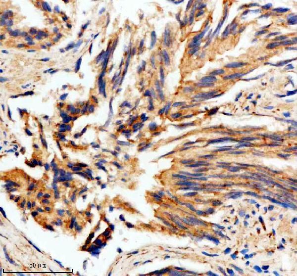 IHC analysis of MTMR3 using anti-MTMR3 antibody (A05937-1)