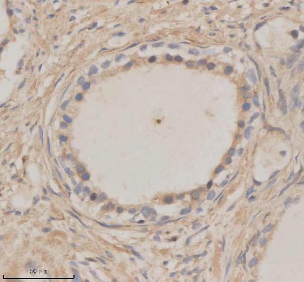 a05937 1 mtmr3 primary antibodies ihc testing 3