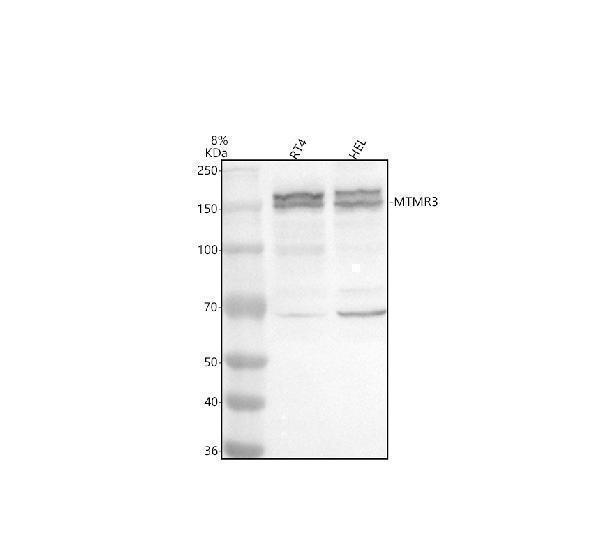 Western blot analysis of MTMR3 using anti-MTMR3 antibody (A05937-1)