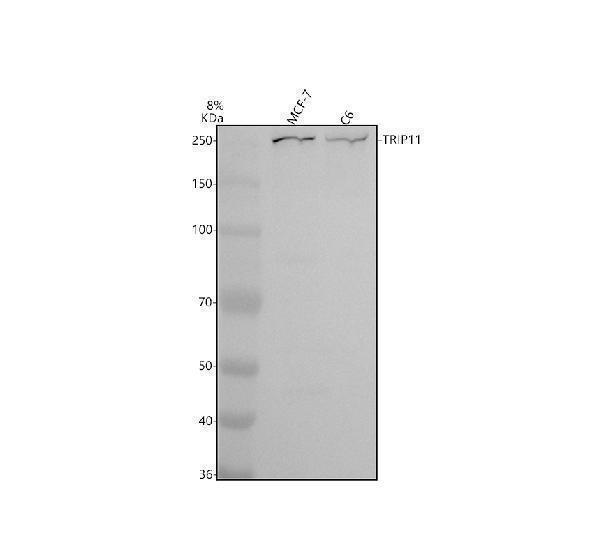 Western blot analysis of TRIP11 using anti-TRIP11 antibody (A05939)