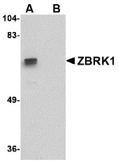 a05943 znf350 primary antibodies wb testing 1