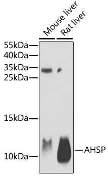 Western blot analysis of extracts of various cell lines, using AHSP antibody  at 1:1000 dilution