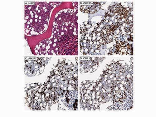 Immunohistochemistry of Rabbit anti-AHSP antibody