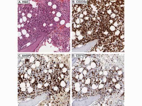 Immunohistochemistry of Rabbit anti-AHSP antibody