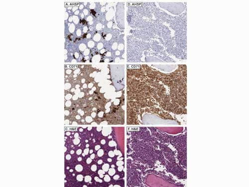 Immunohistochemistry of Rabbit anti-AHSP antibody