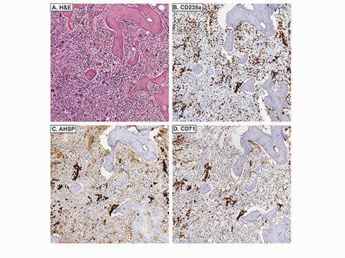 a05948 ahsp primary antibodies ihc testing 4