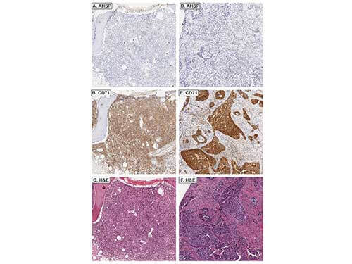 a05948 ahsp primary antibodies ihc testing 5