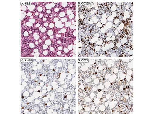 a05948 ahsp primary antibodies ihc testing 6