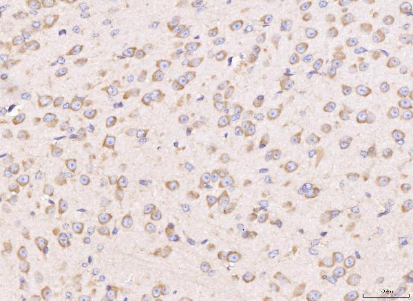  IHC analysis of RPL29 using anti-RPL29 antibody (A05949-1)