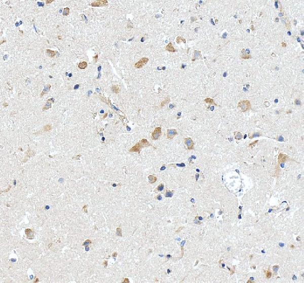 IHC analysis of RPL29 using anti-RPL29 antibody (A05949-1)