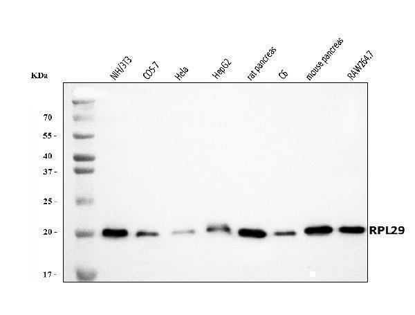  Western blot analysis of RPL29 using anti-RPL29 antibody (A05949-1)