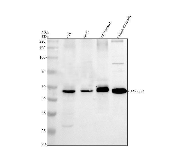 Western blot analysis of TMPRSS4 using anti-TMPRSS4 antibody (A05954-2)