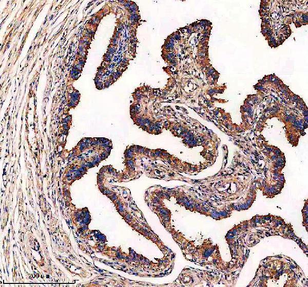 IHC analysis of EFHC1 using anti-EFHC1 antibody (A05955-1)