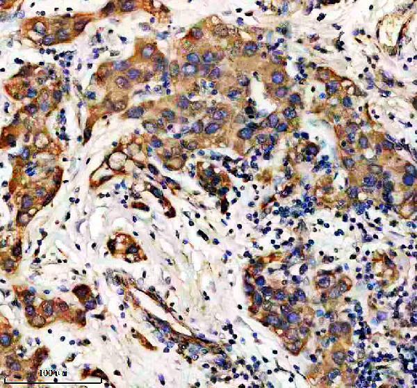 IHC analysis of EFHC1 using anti-EFHC1 antibody (A05955-1)