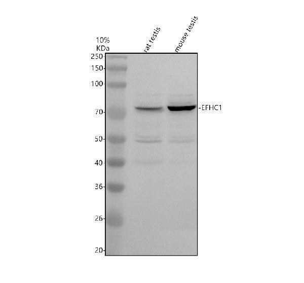 Western blot analysis of EFHC1 using anti-EFHC1 antibody (A05955-1)
