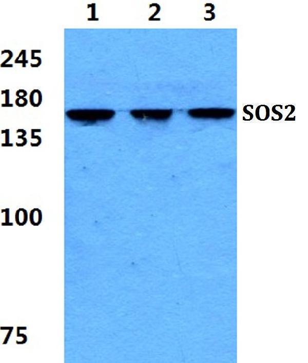 Western blot (WB) analysis of SOS2 polyclonal antibody at 1:500 dilution
Lane1:Hela cell lysate
Lane2:sp2/0 cell lysate
Lane3:H9C2 cell lysate