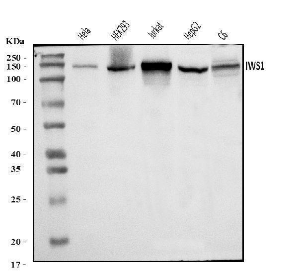  Western blot analysis of IWS1 using anti-IWS1 antibody (A05958-1)