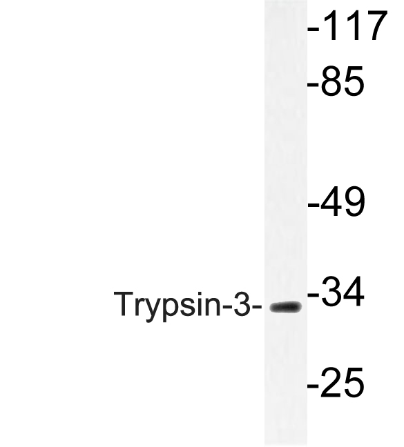 Western blot analysis of lysate from A549 cells, using Trypsin-3 antibody