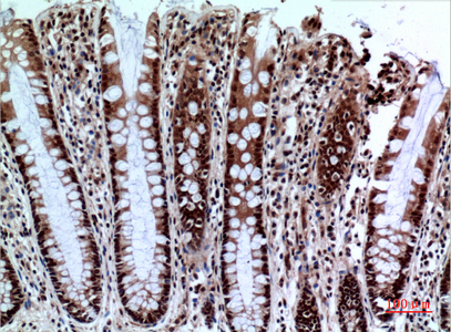 a05962 1 ncr2 primary antibodies ihc testing 1