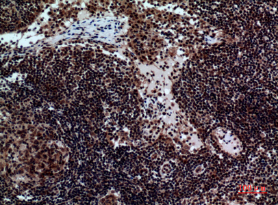a05962 1 ncr2 primary antibodies ihc testing 3