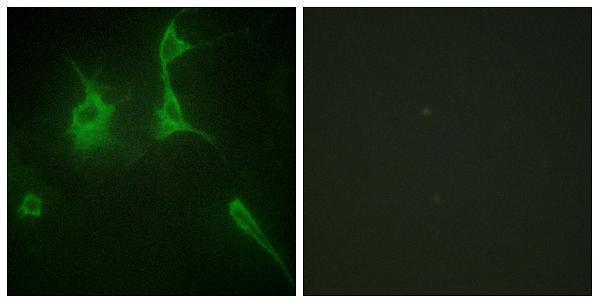 a05963 col9a3 primary antibodies if testing 1