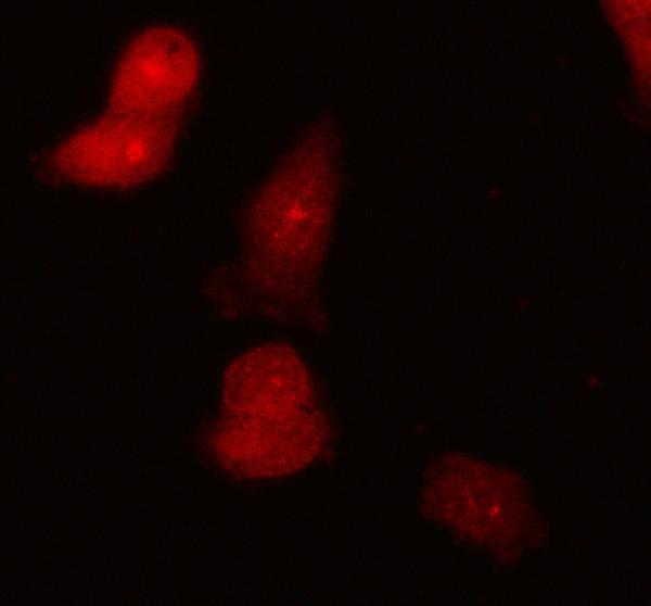 a05964 1 stambp primary antibodies if testing 9
