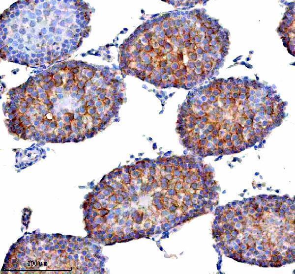  IHC analysis of STAMBP using anti-STAMBP antibody (A05964-1)