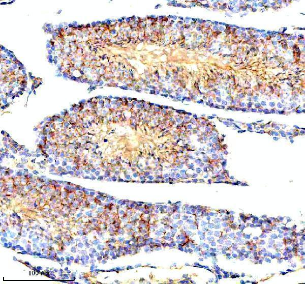  IHC analysis of STAMBP using anti-STAMBP antibody (A05964-1)