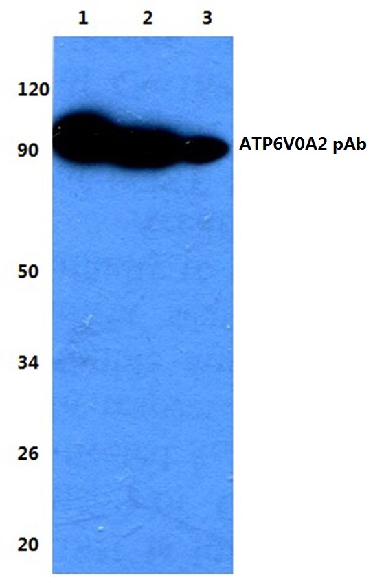 a05969 atp6v0a2 primary antiboties wb testing 1
