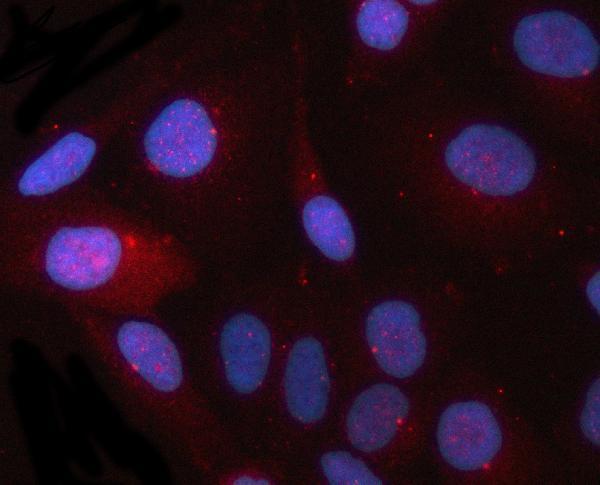 a05971 1 cep164 primary antibodies if testing 2