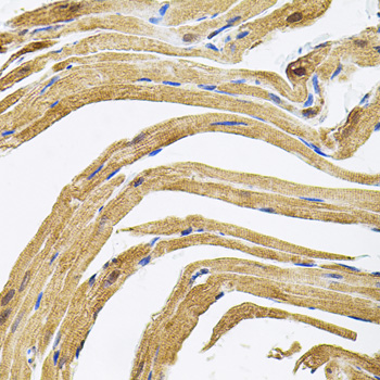 a05971 cep164 primary antiboties ihc testing 2