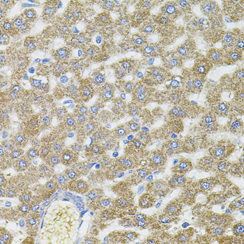 a05971 cep164 primary antiboties ihc testing 3