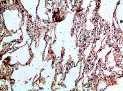 Immunohistochemical analysis of paraffin-embedded human-lung, antibody was diluted at 1:200