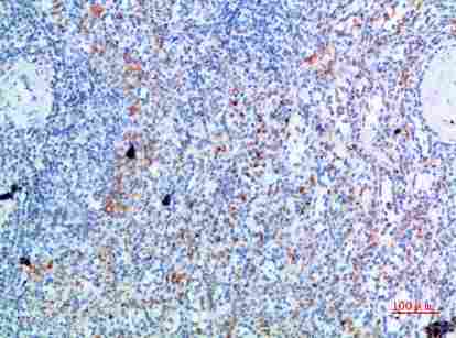 Immunohistochemical analysis of paraffin-embedded human-spleen, antibody was diluted at 1:200