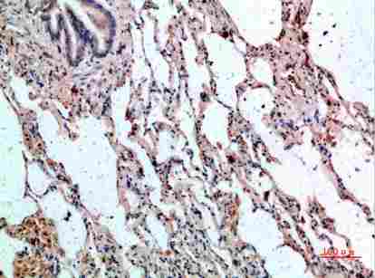 Immunohistochemical analysis of paraffin-embedded human-lung, antibody was diluted at 1:200