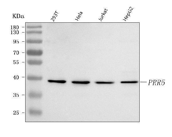  Western blot analysis of PRR5 using anti-PRR5 antibody (A05975-1)