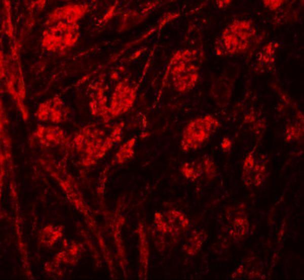 a05975 prr5 primary antibodies if testing 3