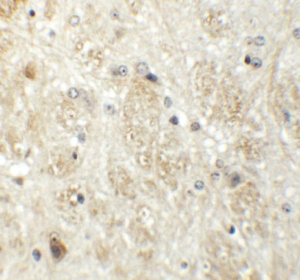 a05975 prr5 primary antibodies ihc testing 2