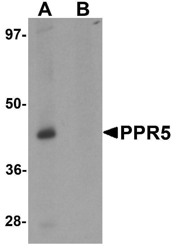 a05975 prr5 primary antibodies wb testing 1