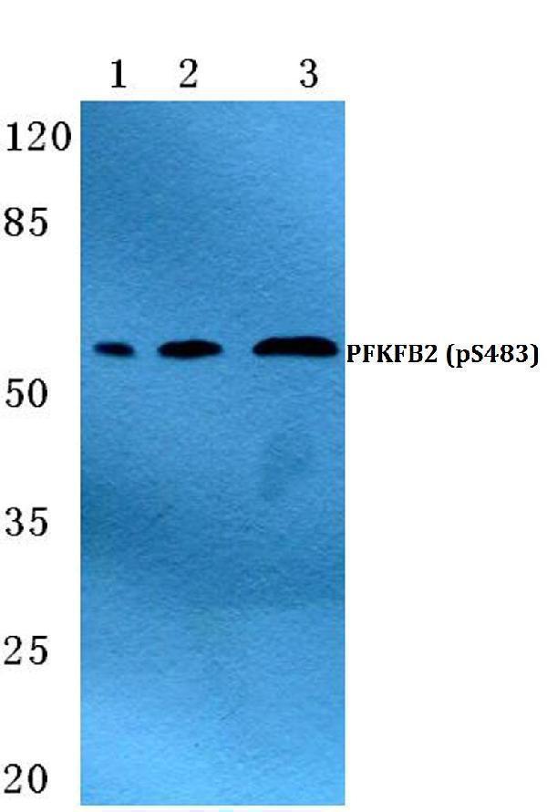 Western blot (WB) analysis of p-PFKFB2 (S483) polyclonal antibody at 1:500 dilution
Lane1:Hela cell lysate treated with H2O2(100µM,30mins)
Lane2:sp2/0 cell lysate treated with H2O2(100µM,30mins)
Lane3:H9C2 cell lysate treated with H2O2(100µM,30mins)