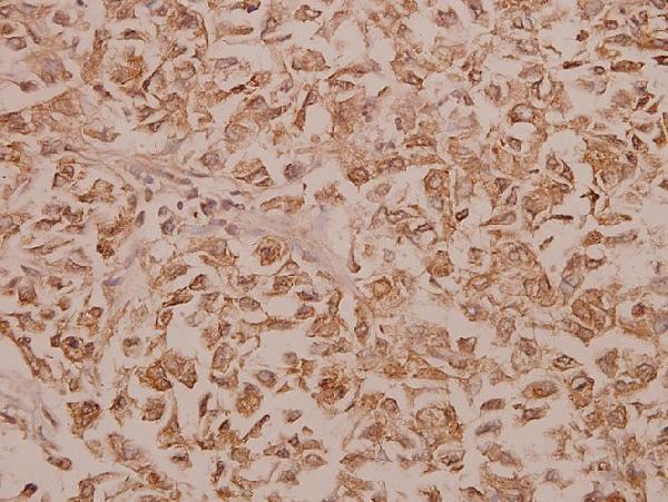 a05977y14 pfkfb2 primary antiboties ihc testing 2