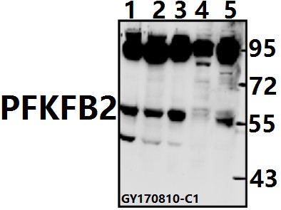 a05977y14 pfkfb2 primary antiboties wb testing 1