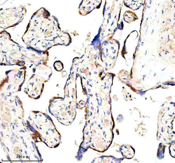 a05980 3 hapln1 primary antibodies ihc testing 1