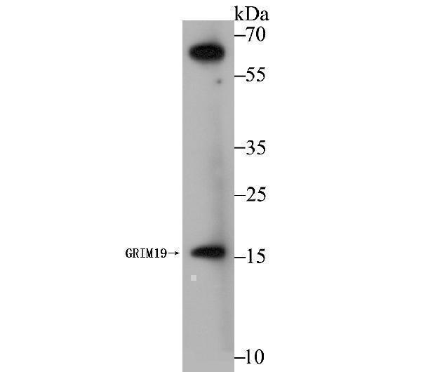 a05981 1 ndufa13 primary antiboties wb testing 1